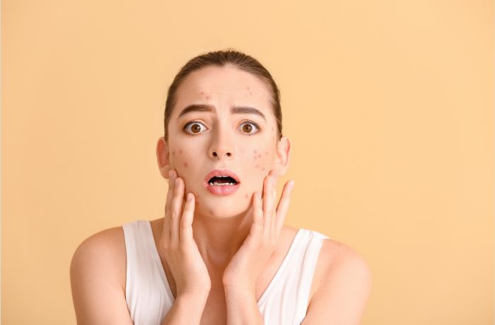 Mengapa Kulit Masih Terlihat Kusam Padahal Sudah Rutin Skincare?